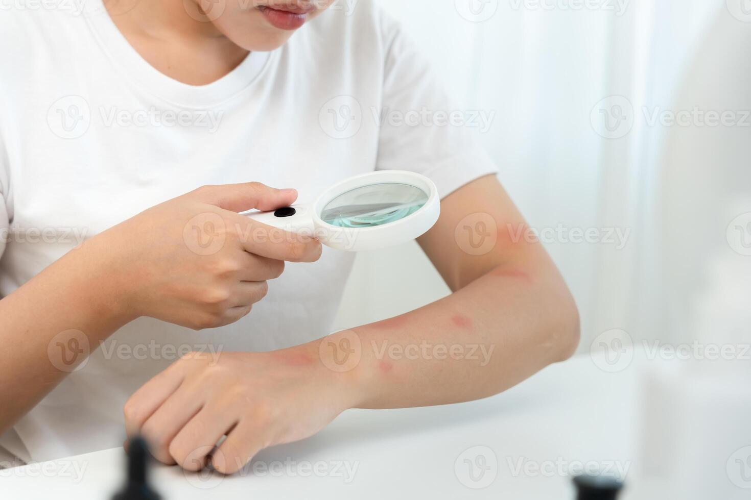 skin problem and beauty asian woman use magnifying glass look itchy skin from skin allergic, shocked, steroid allergy, sensitive, chemical allergy, rash, insect bites, Seborrheic Dermatitis. photo