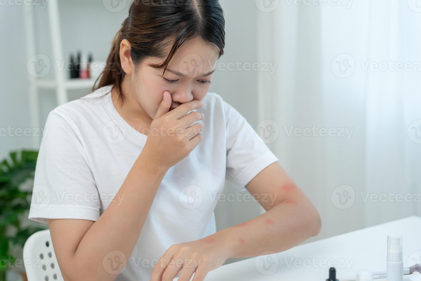 skin problem and beauty. Young woman scratch body has itchy skin from skin allergic, steroid allergy, sensitive skin, red from sunburn, chemical allergy, rash insect bites, Seborrheic Dermatitis photo