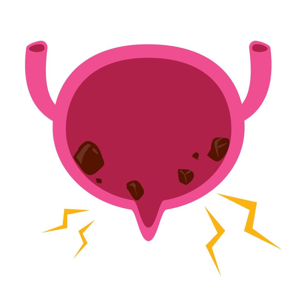Bladder with stones illustration vector