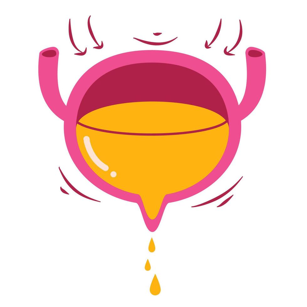Urinary incontinence illustration. Bladder disease illustration vector