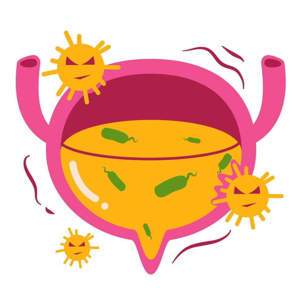 Bladder infection illustration vector