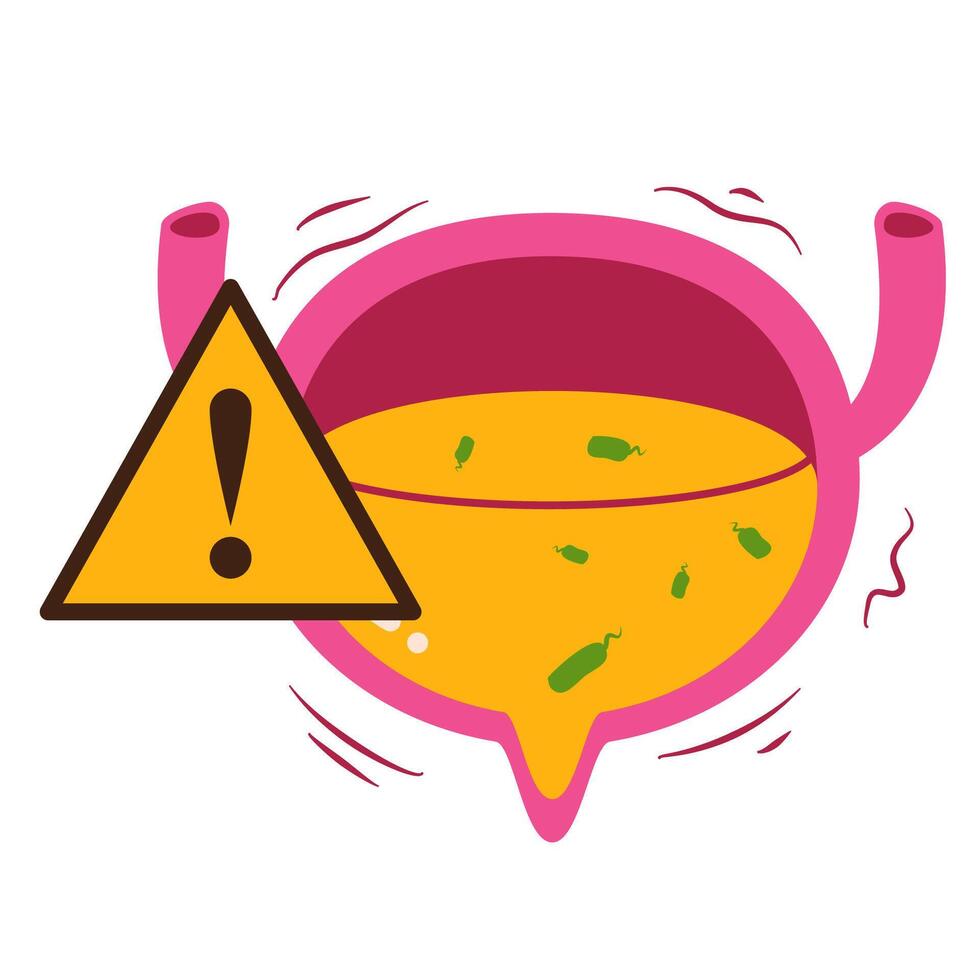 Urinary tract infection illustration vector