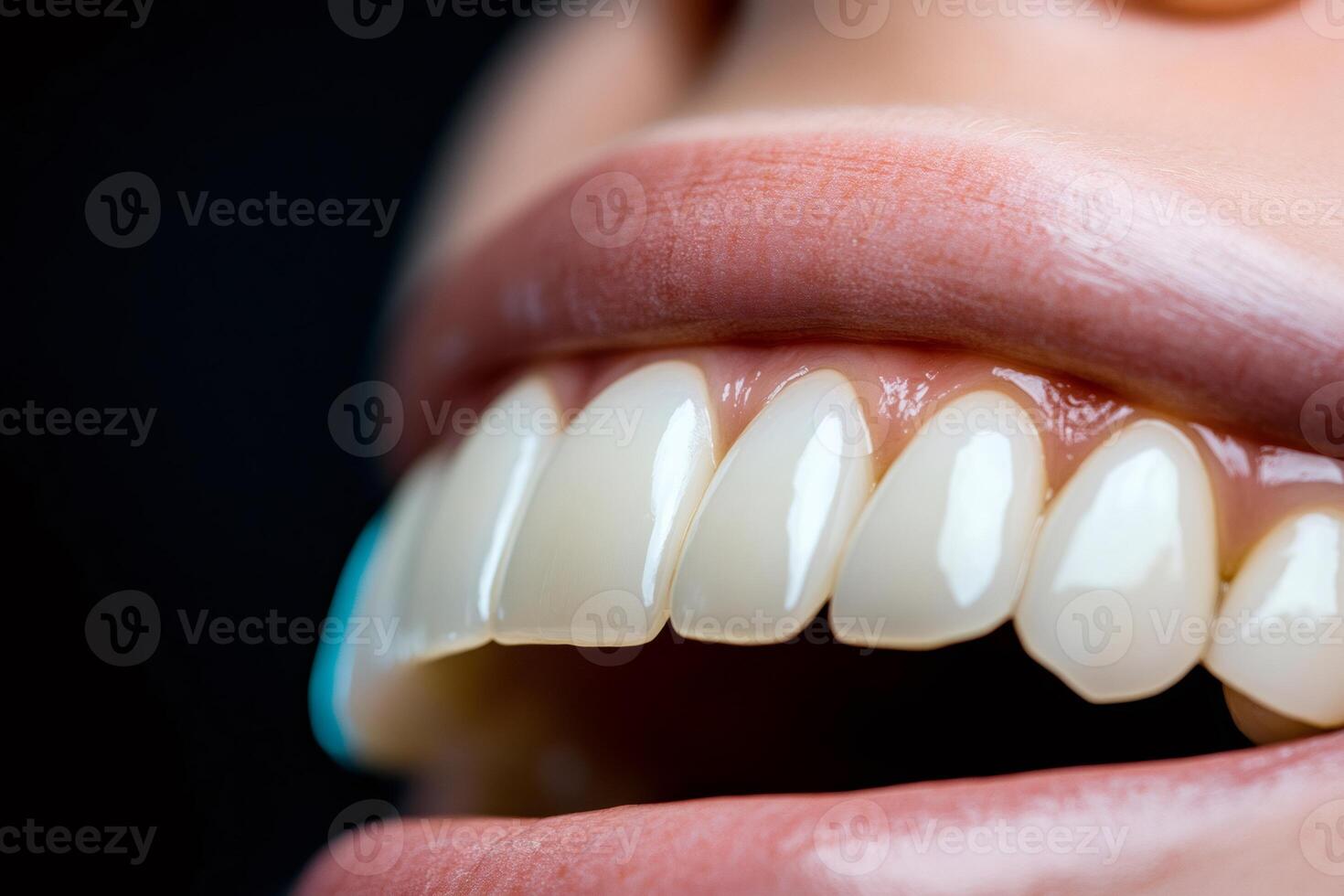 Perfect smile showing healthy white teeth with veneers treatment photo