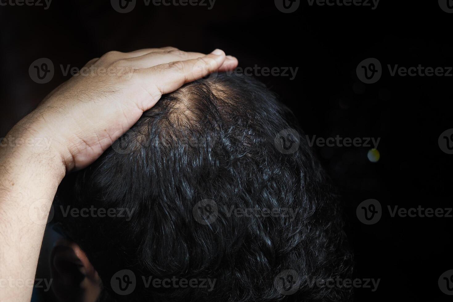 Man touching his balding scalp in a dimly lit setting photo