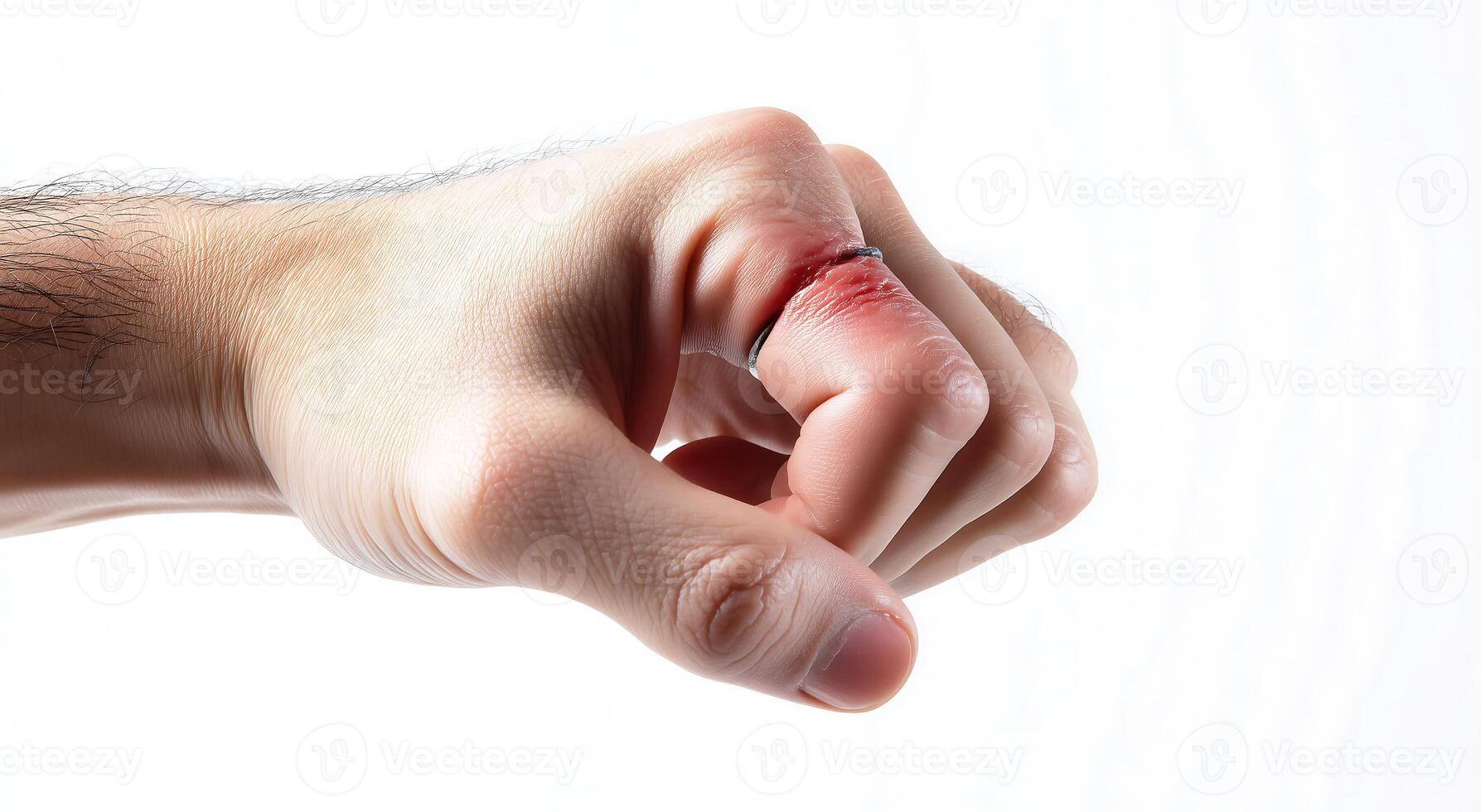 Hand Fist Clenching Injury with Ring Hand Injury Close-Up, Used in Medical, Self-Defense, or Protest Contexts photo