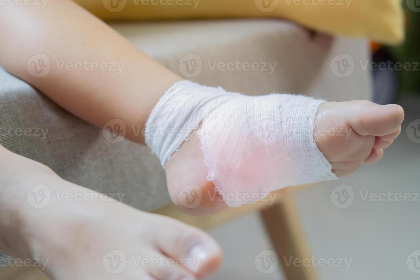 Cropped image of little boy' feet with gauze bandage. Selective focus. photo