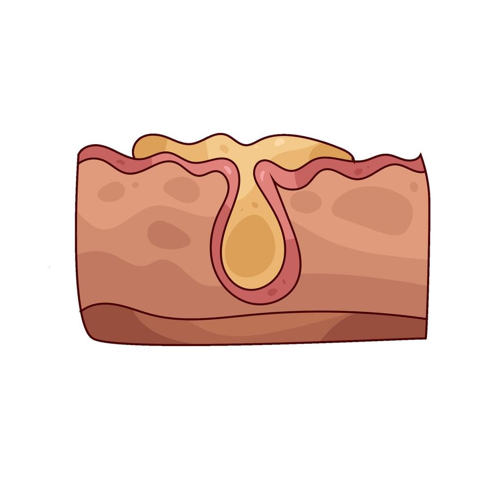 Illustration of a sebum vector
