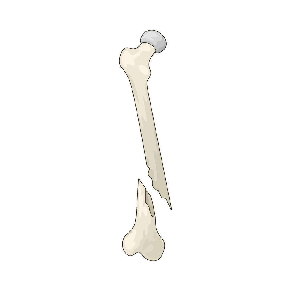 human broken bone vector