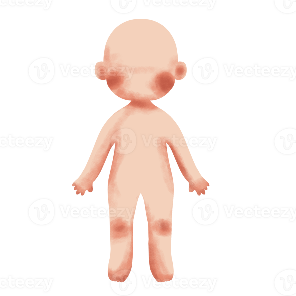 A cartoon baby with a rash on its face png