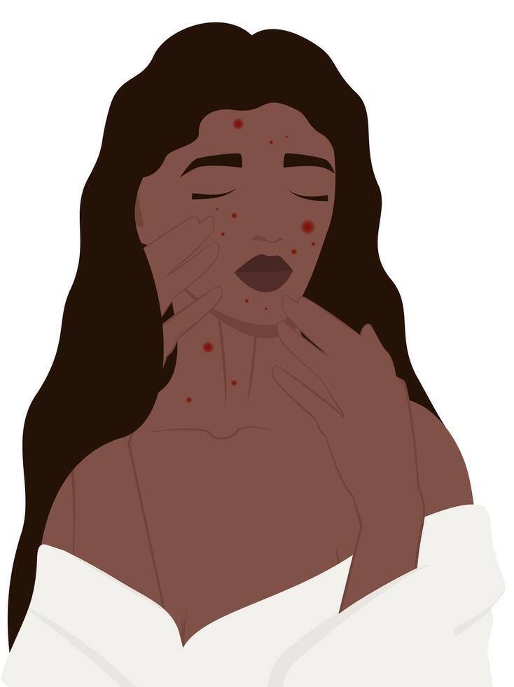 Afro woman with acne, problem skin concept. Cartoon scene skin problem vector