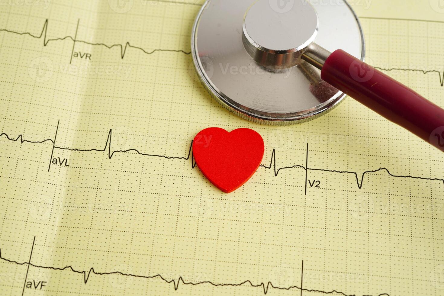 Stethoscope on electrogram, heart wave, heart photo