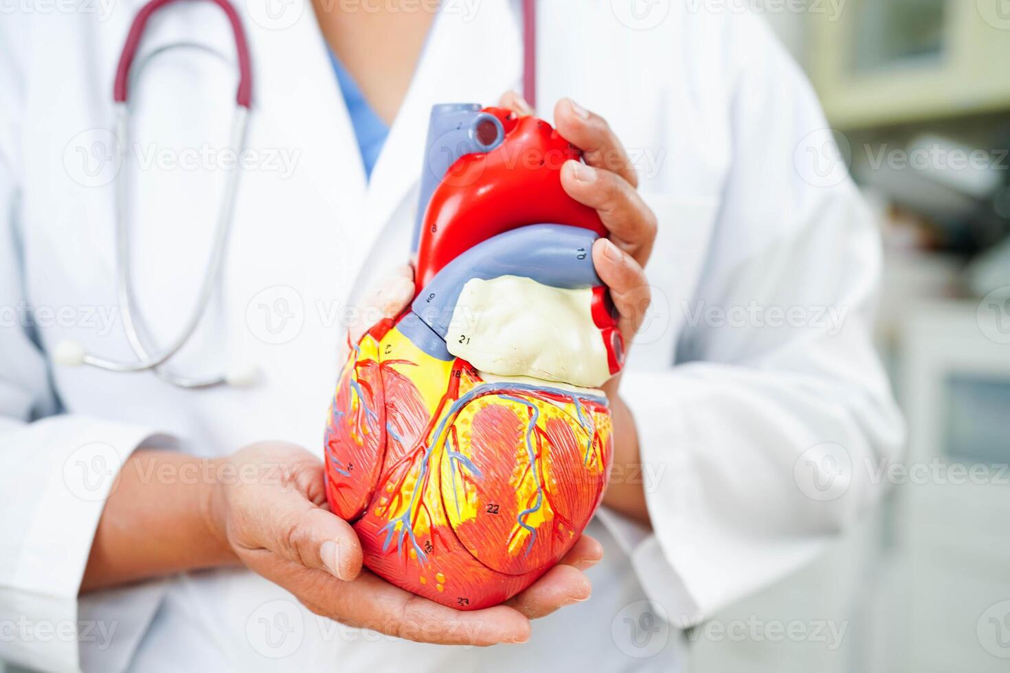 Cardiovascular disease CVD, doctor with heart human model anatomy for treatment patien photo