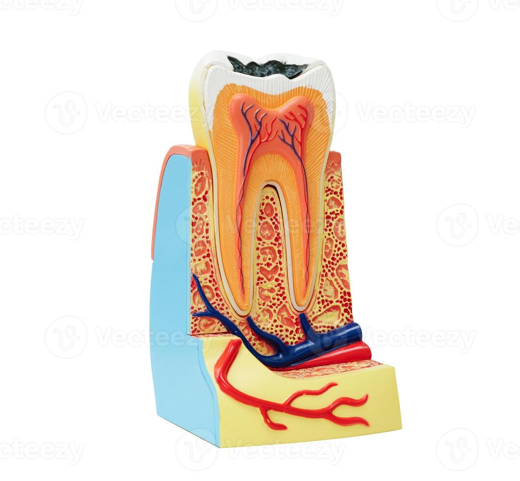 Dental implant, artificial tooth roots into jaw isolated on white background with clipping path. photo