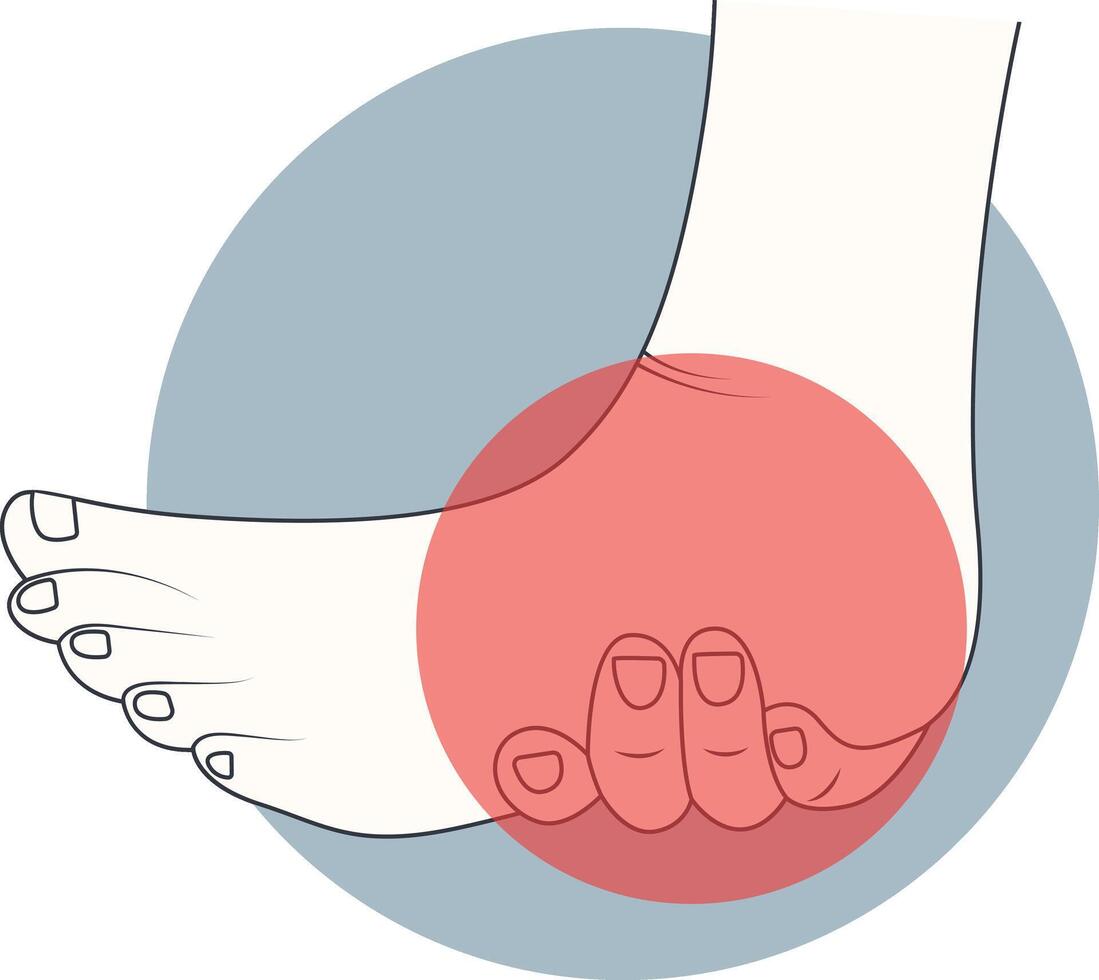 Illustration of Pain Leg vector