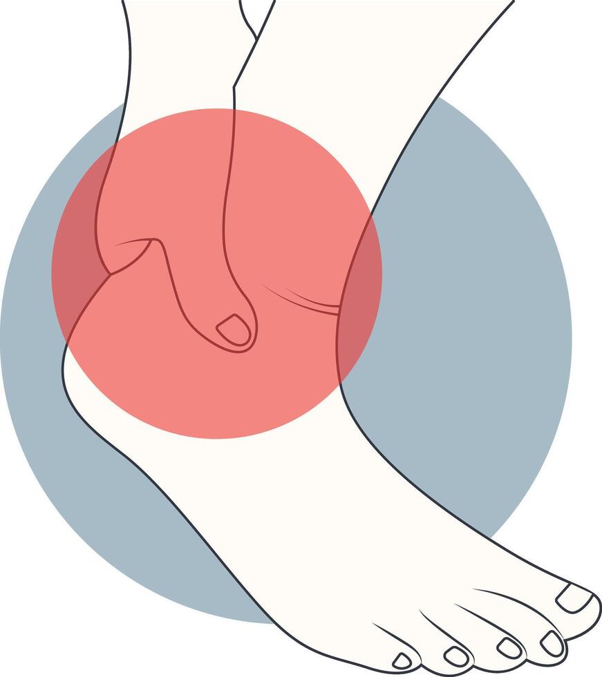 Illustration of Pain on Hand and Leg, Isolated on White Background vector