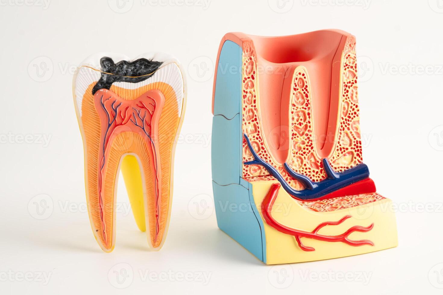 Dental implant, artificial tooth roots into jaw isolated photo
