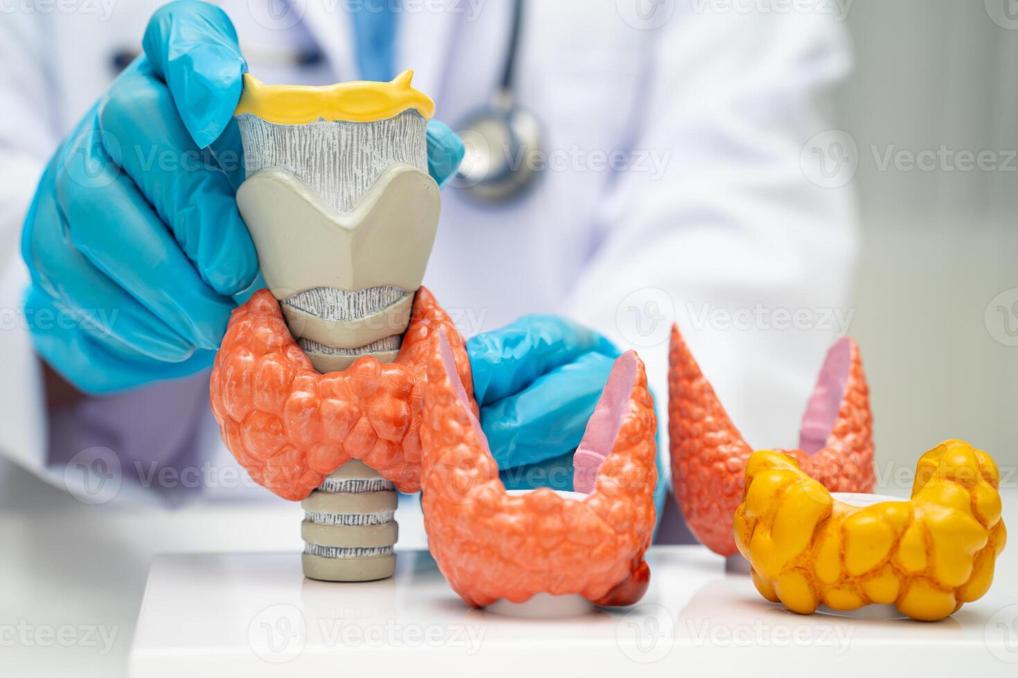 Hyperthyroidism, Overactive Thyroid, Thyroid Lymphoma, Asian doctor with thyroid photo