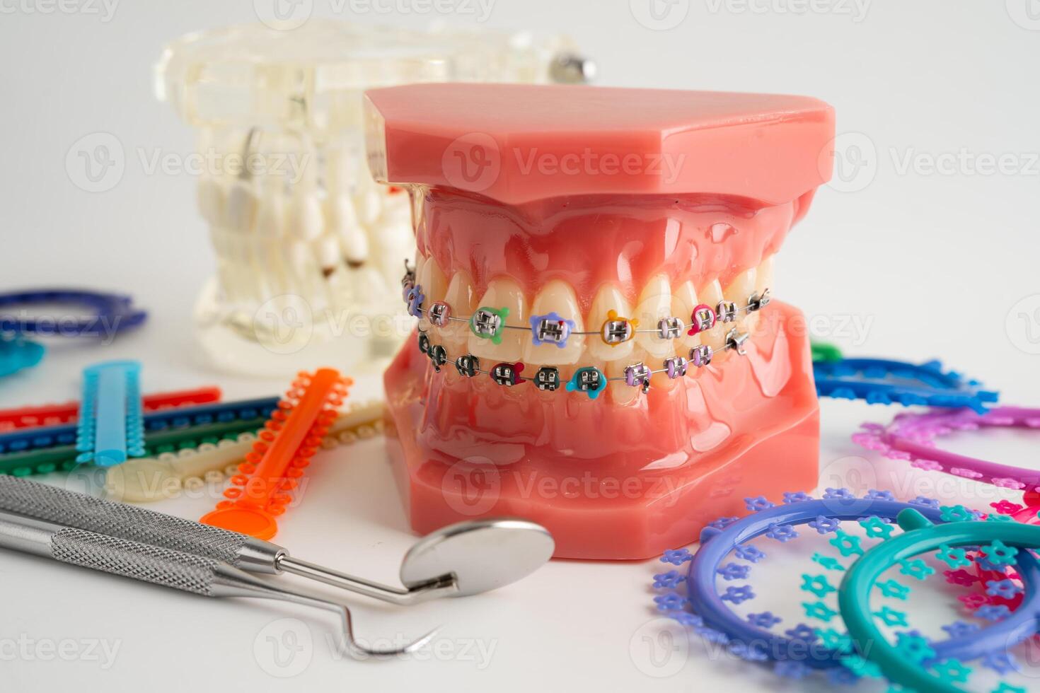 Orthodontic ligatures rings and ties photo