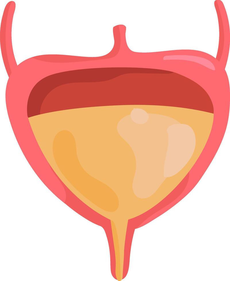 Medical illustration of a partially full human bladder showing urine, detrusor muscle, ureters and urethra, useful for educational and healthcare purposes vector