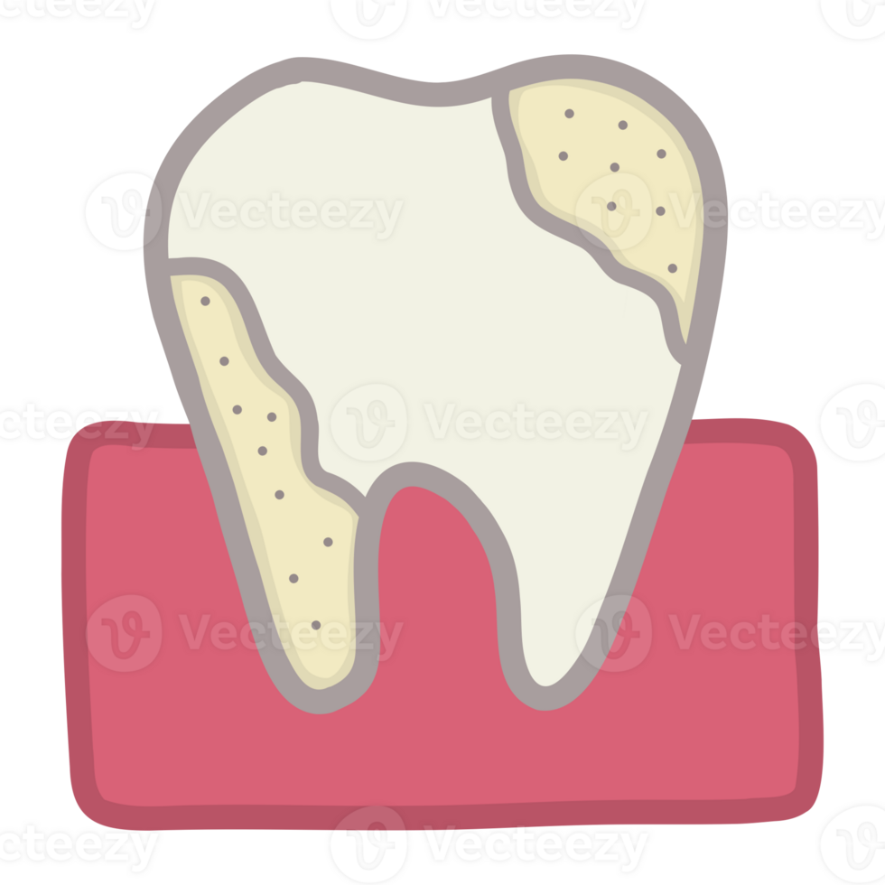 Tooth with a crack png