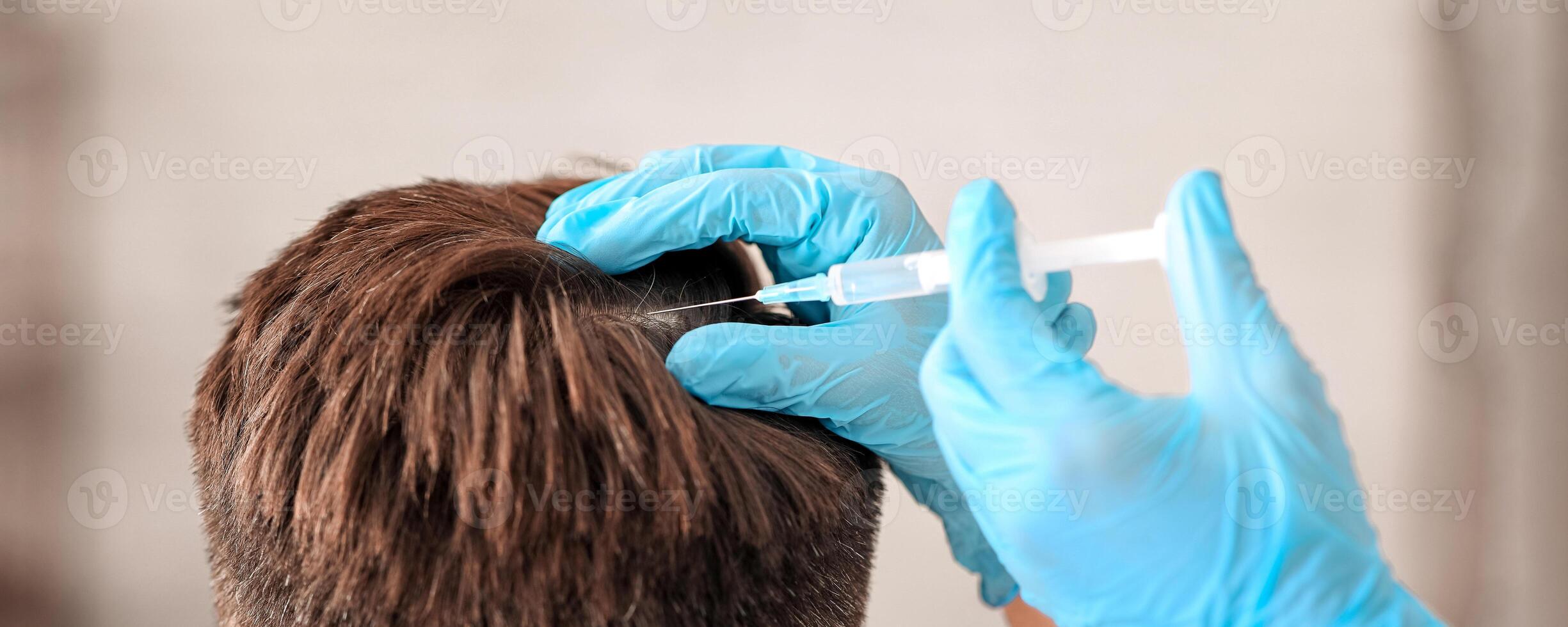 Unrecognizable middle aged man getting hair treatment at beauty salon, back view. Man having mesotherapy session at beauty salon, therapist hand in protective glove making injection in scalp, closeup photo