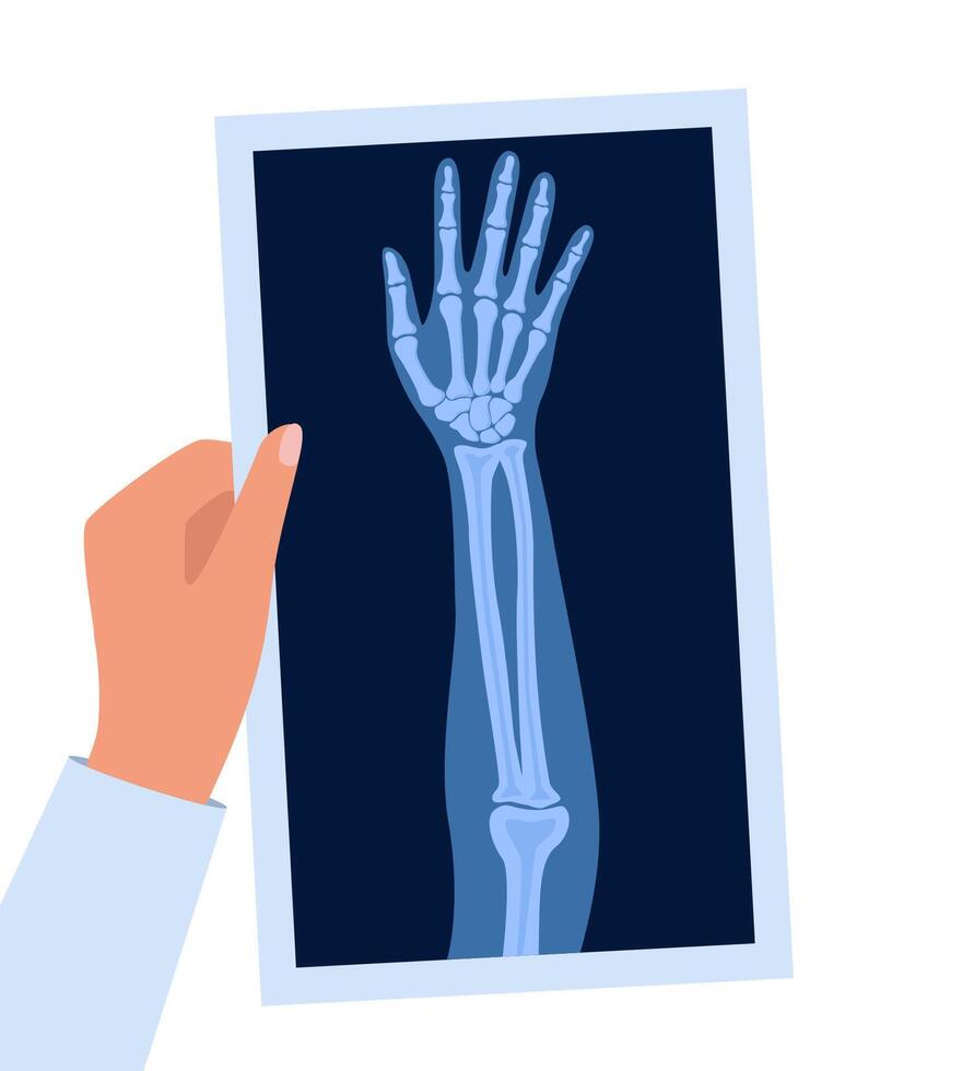 X ray human hand. Body bone roentgen front view. Arm checking healthcare joint palm finger exam. Roentgen shot in doctors hand. illustration. vector