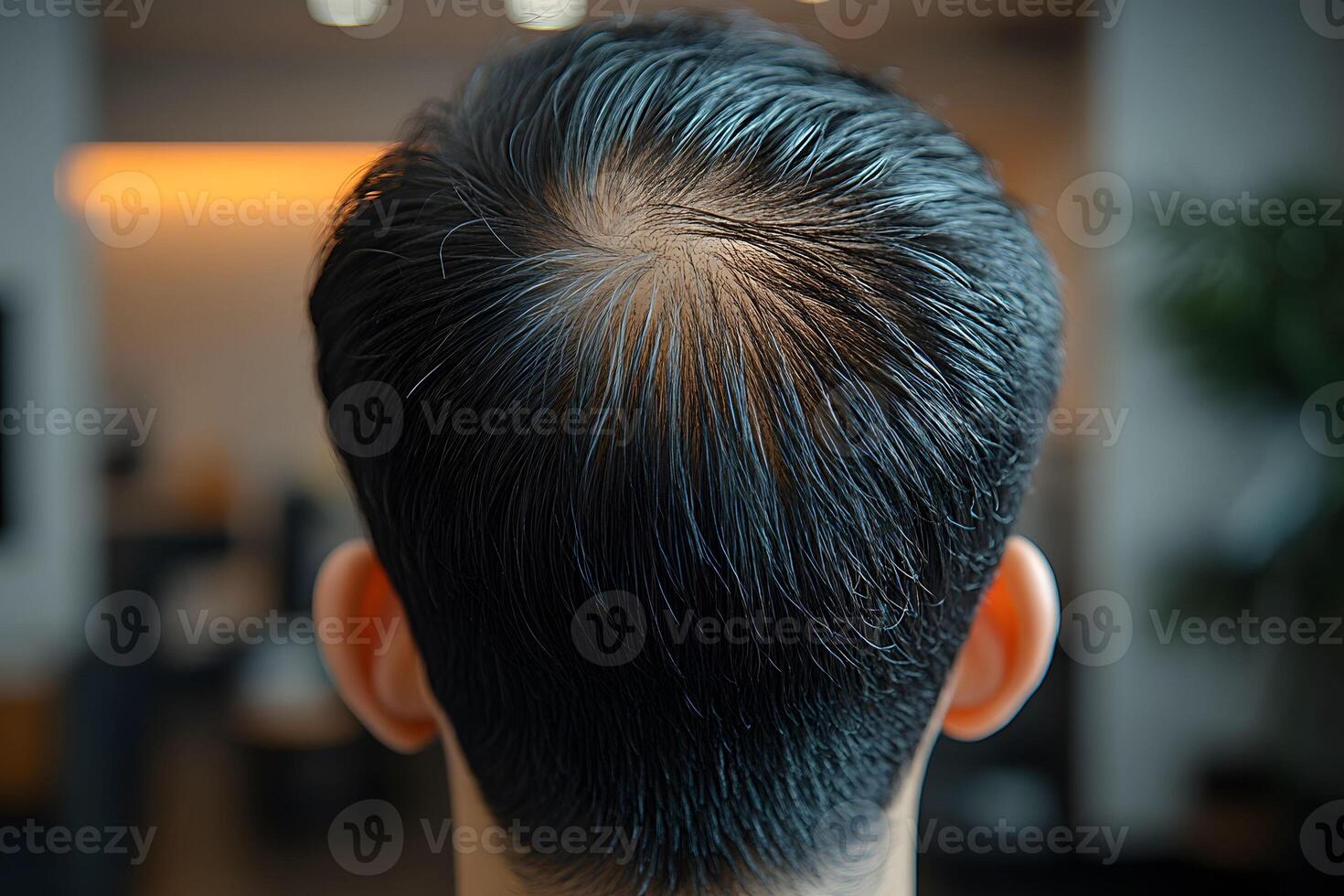 Male Hair Loss Concept Focus on Thinning and Balding at the Crown photo