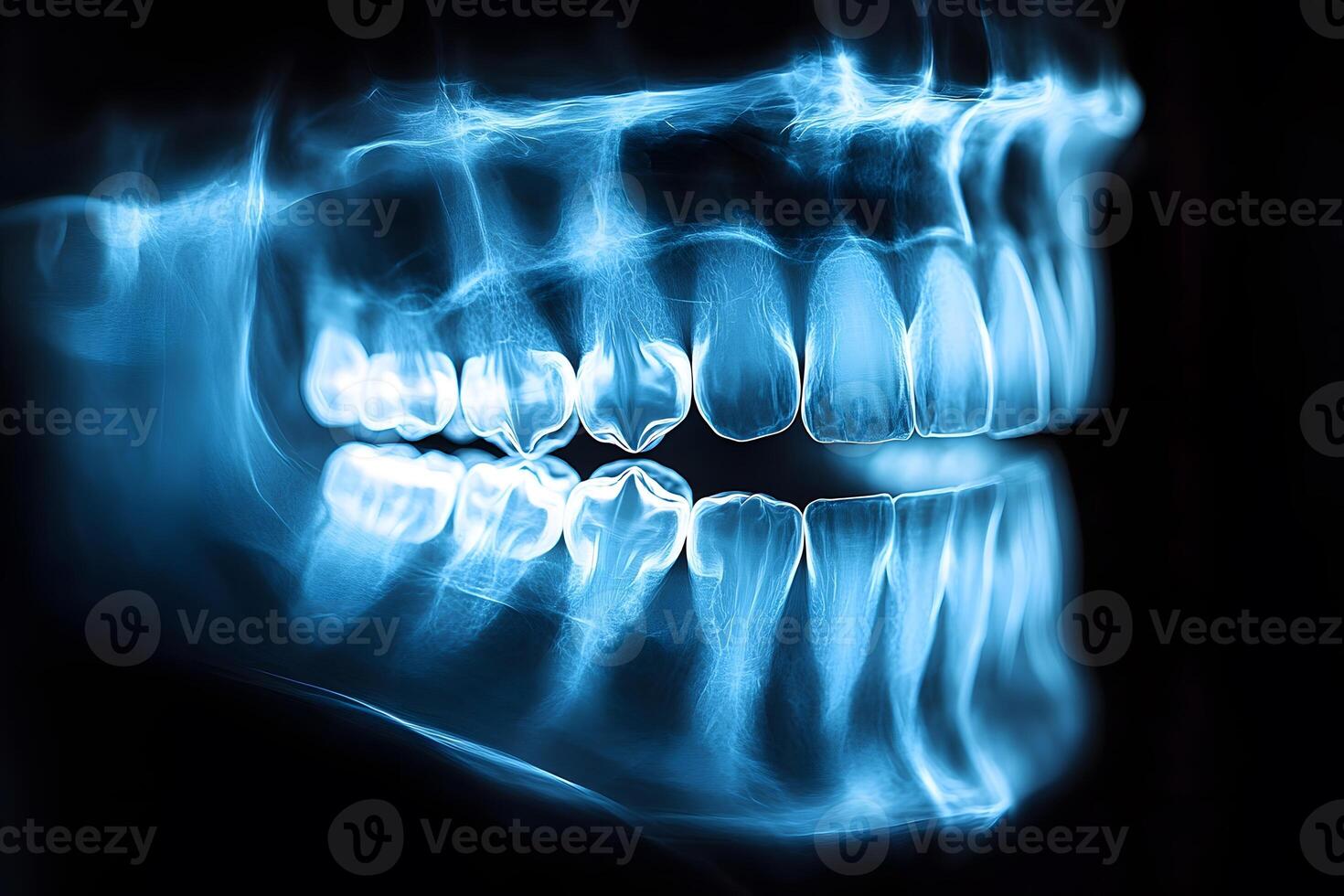 Dental X-Ray Imaging Detailed View of Human Teeth and Jaw Structure for Medical Analysis photo