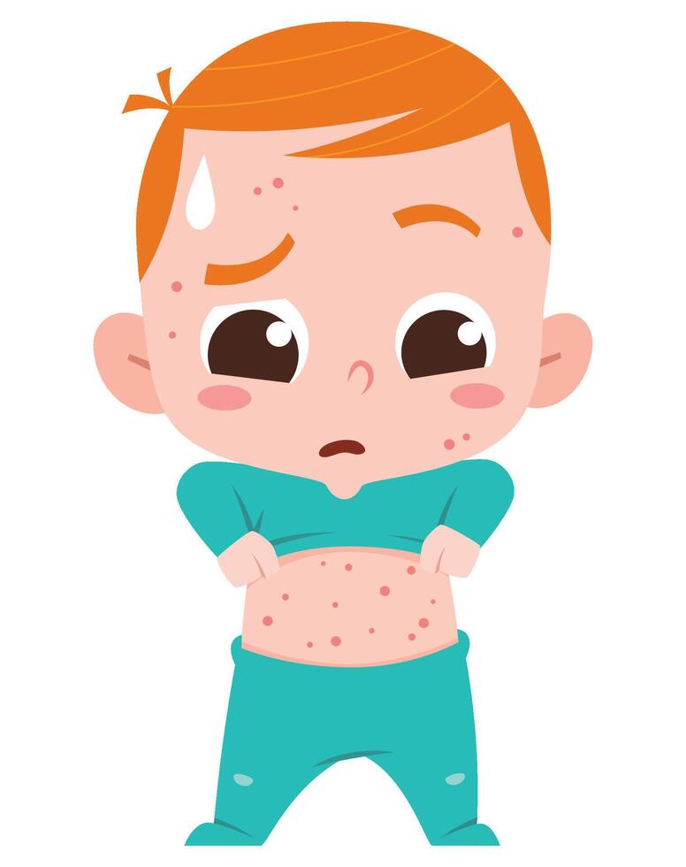 Baby with Skin Rash and Sweat vector