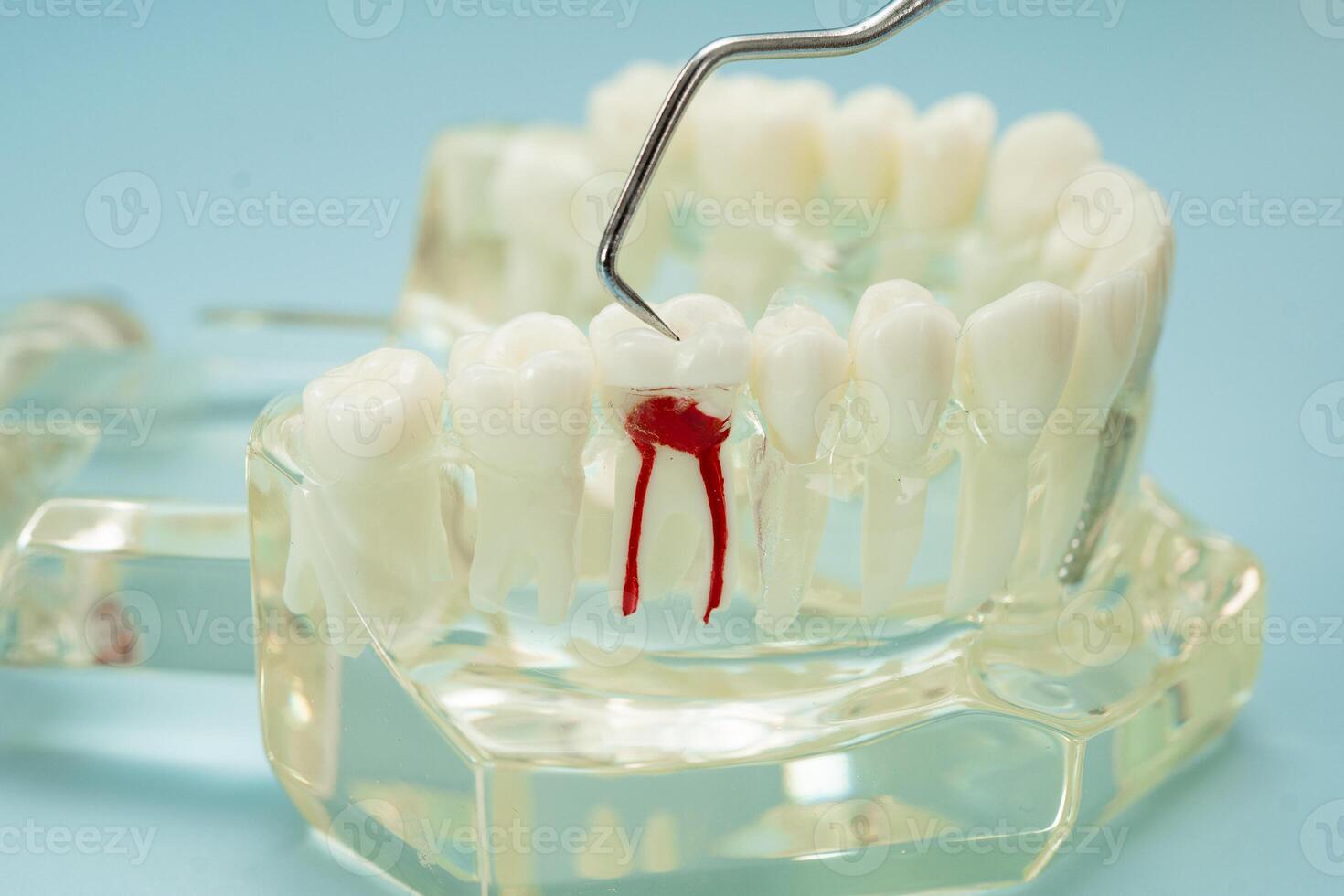 Dental teeth model dentist photo