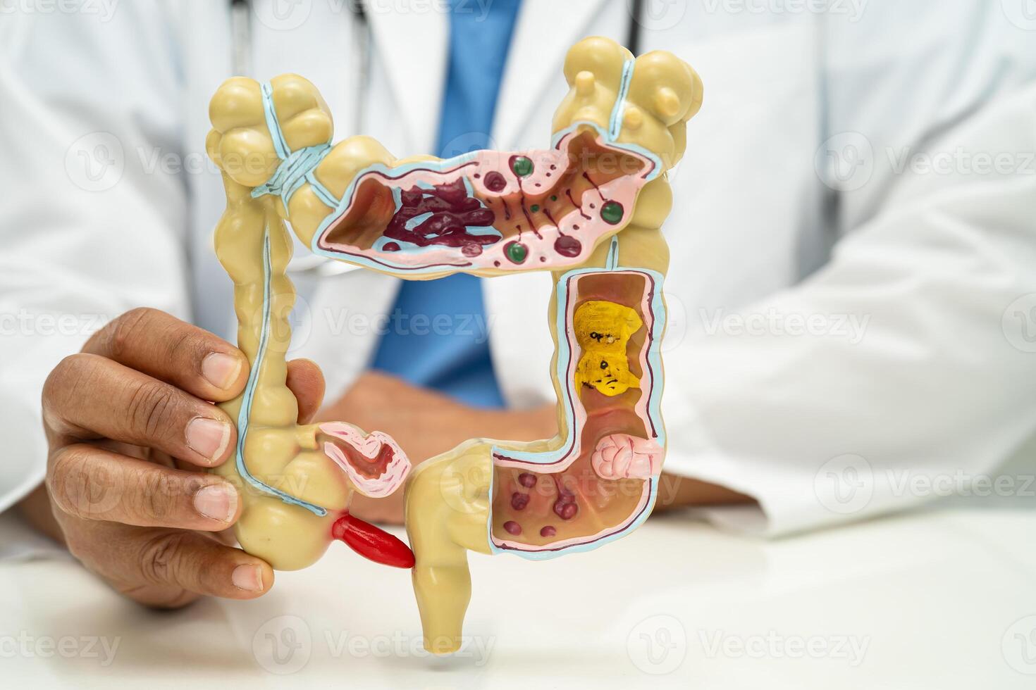 Intestine, appendix and digestive system, doctor holding anatomy model for study photo