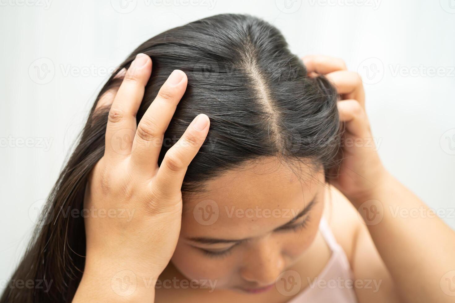 Asian women have problems with itchy scalp and dandruff. photo
