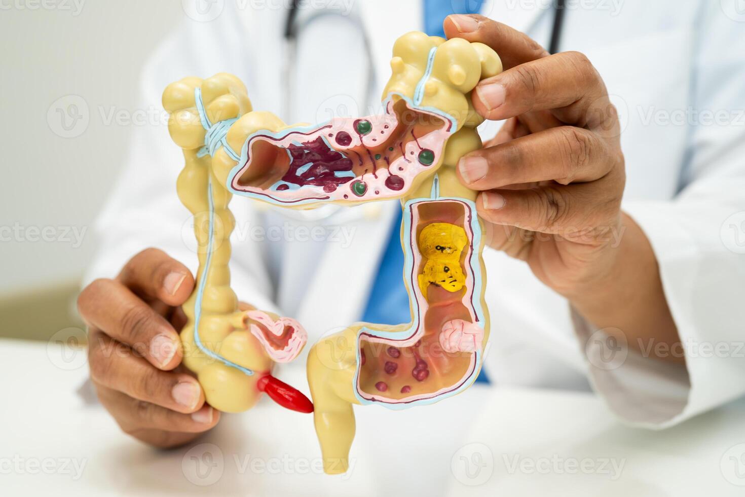 Intestine, appendix and digestive system, doctor holding anatomy model for study diagnosis and photo