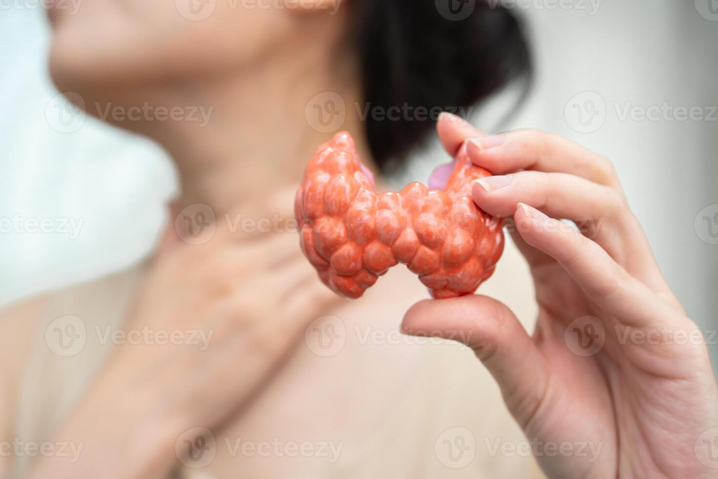Hyperthyroidism Overactive Thyroid, Thyroid Lymphoma, Asian woman with thyroid gland human anatomy model. photo