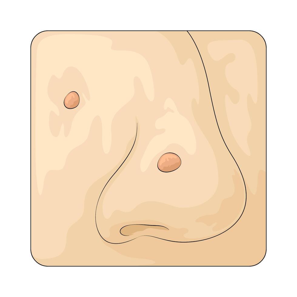 acne on nose vector