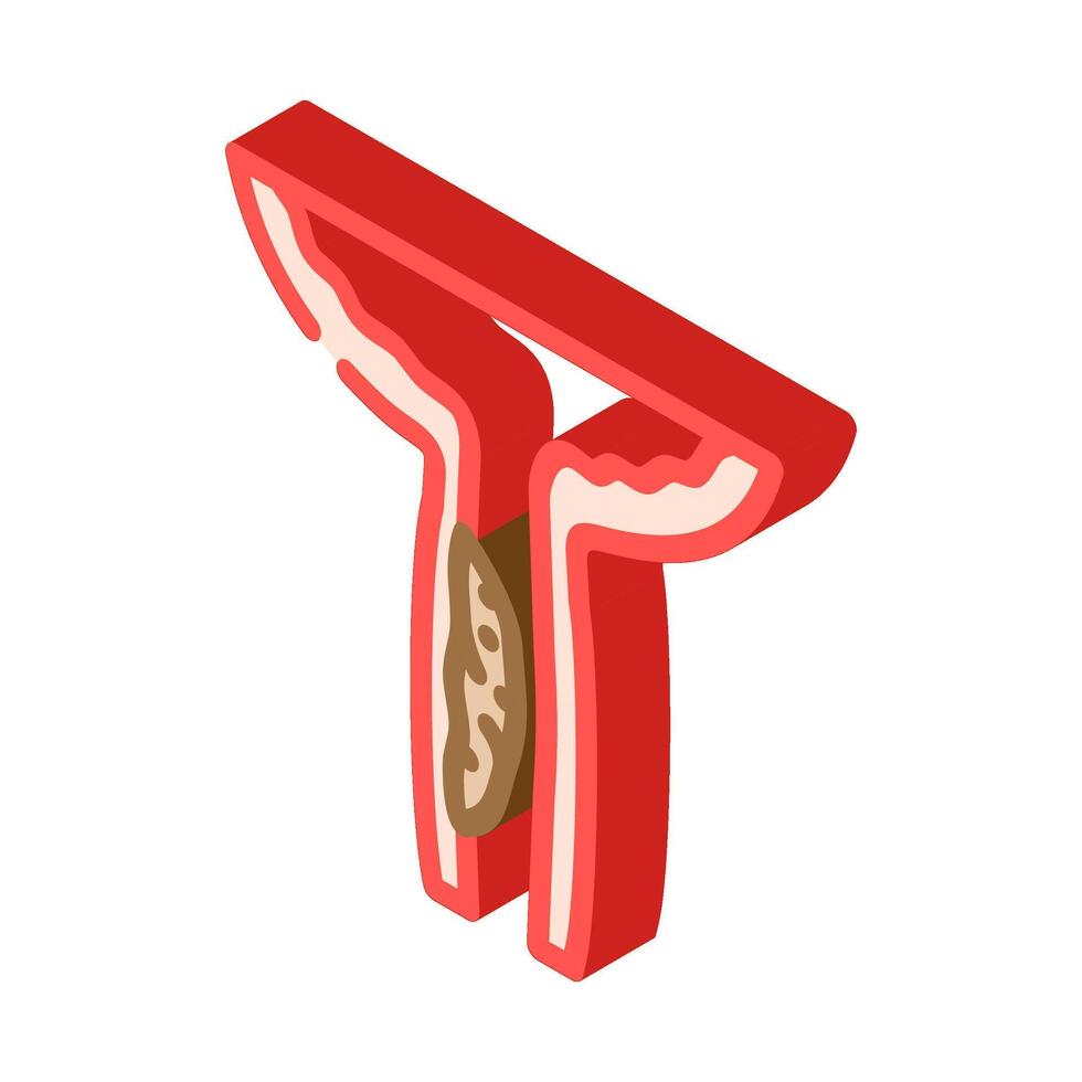 urethral stricture urology isometric icon illustration vector