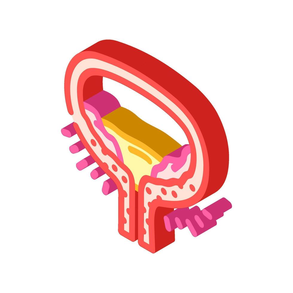 cystitis urology isometric icon illustration vector
