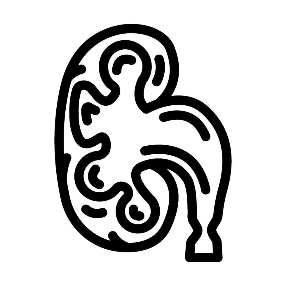 hydronephrosis urology line icon illustration vector