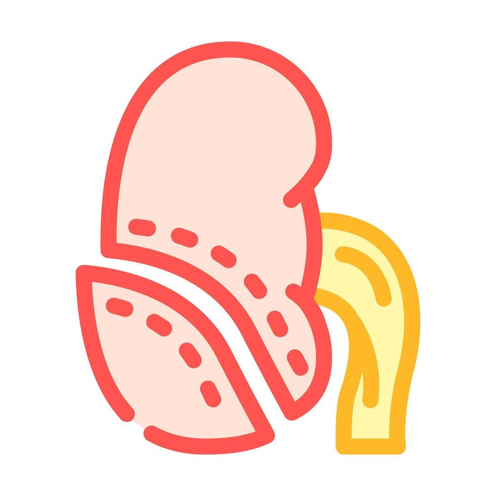 nephrectomy urology color icon illustration vector