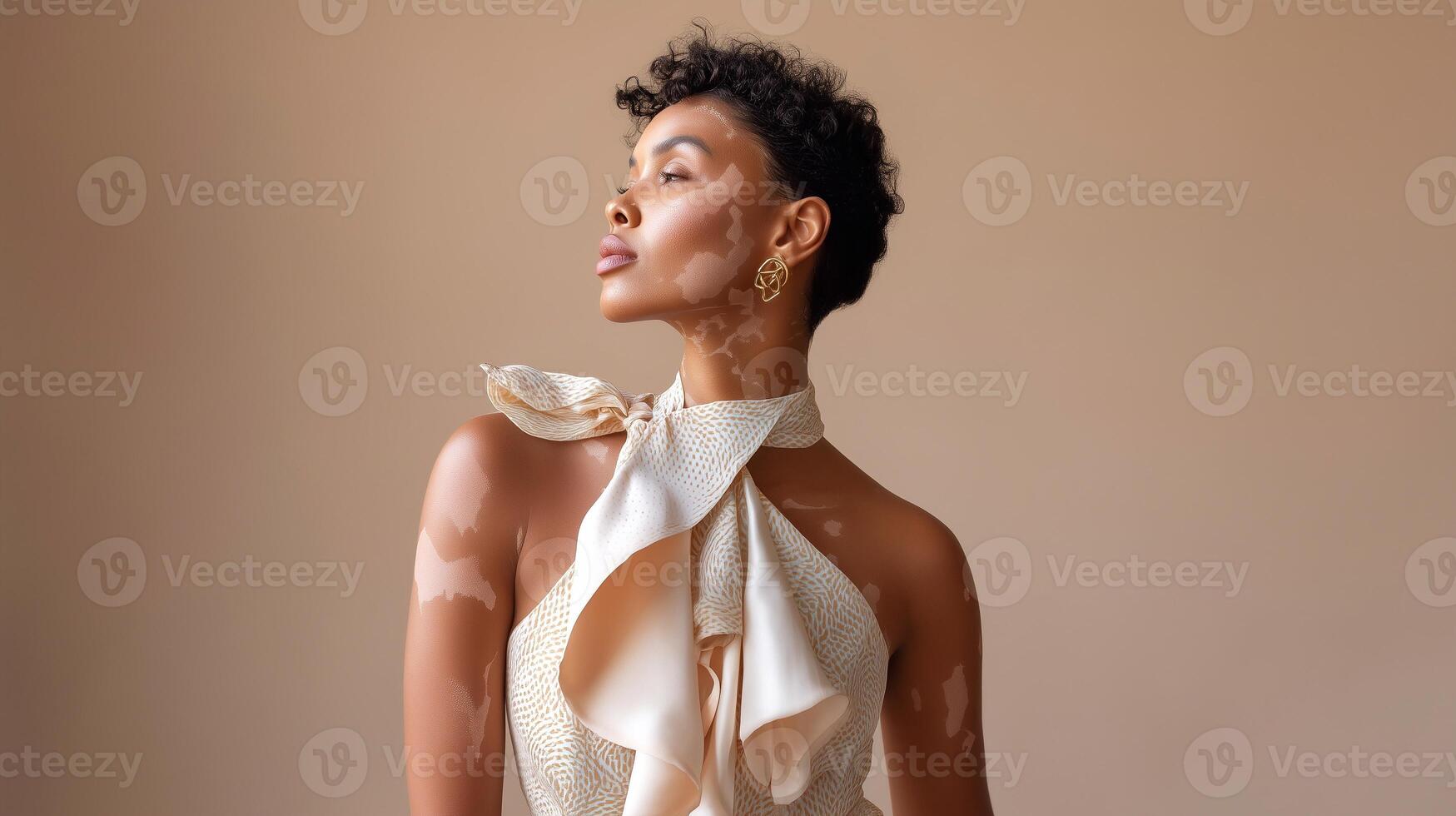 Elegant woman with vitiligo embracing natural beauty and diversity. Confident expression of uniqueness, grace, and modern femininity. Soft lighting and neutral tones. photo