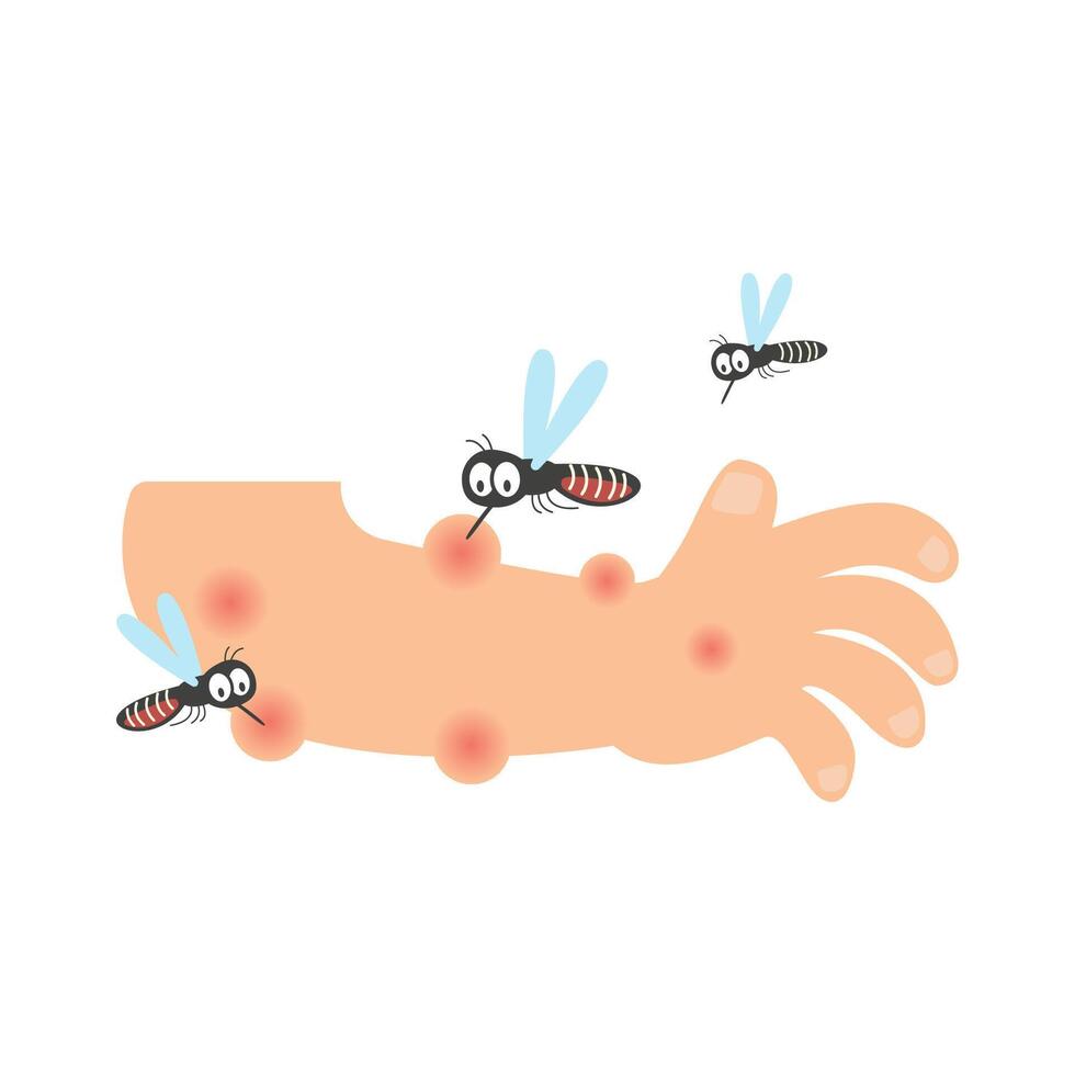 mosquito bite arm. dengue fever concept vector