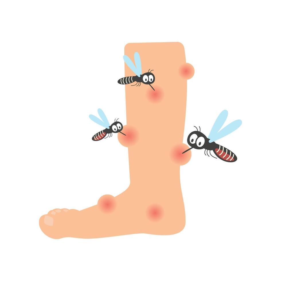 mosquito bite leg. dengue fever concept vector