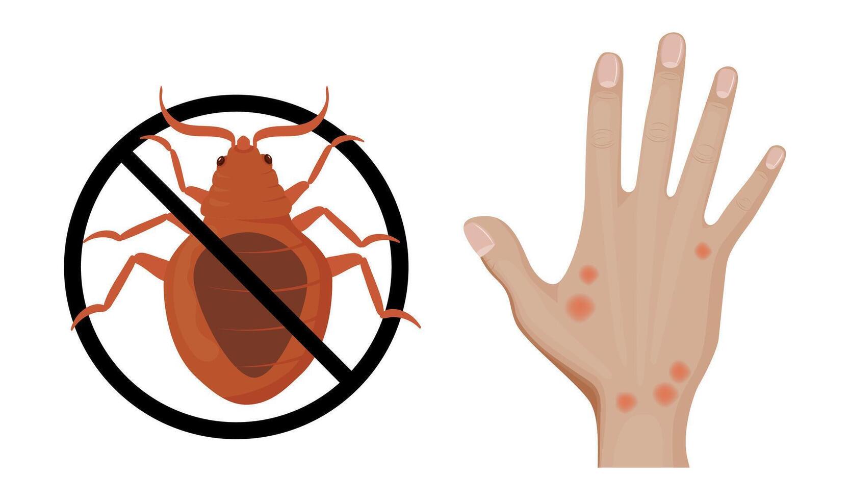 Stop bed bugs and skin rash caused by parasite bites vector