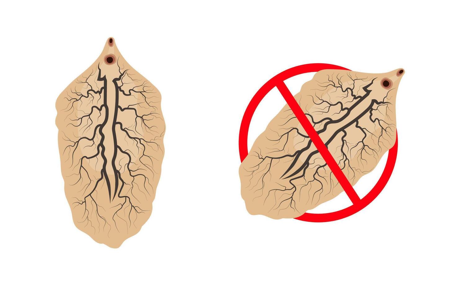 Liver fluke and stop sign representing prevention and treatment of fascioliasis vector