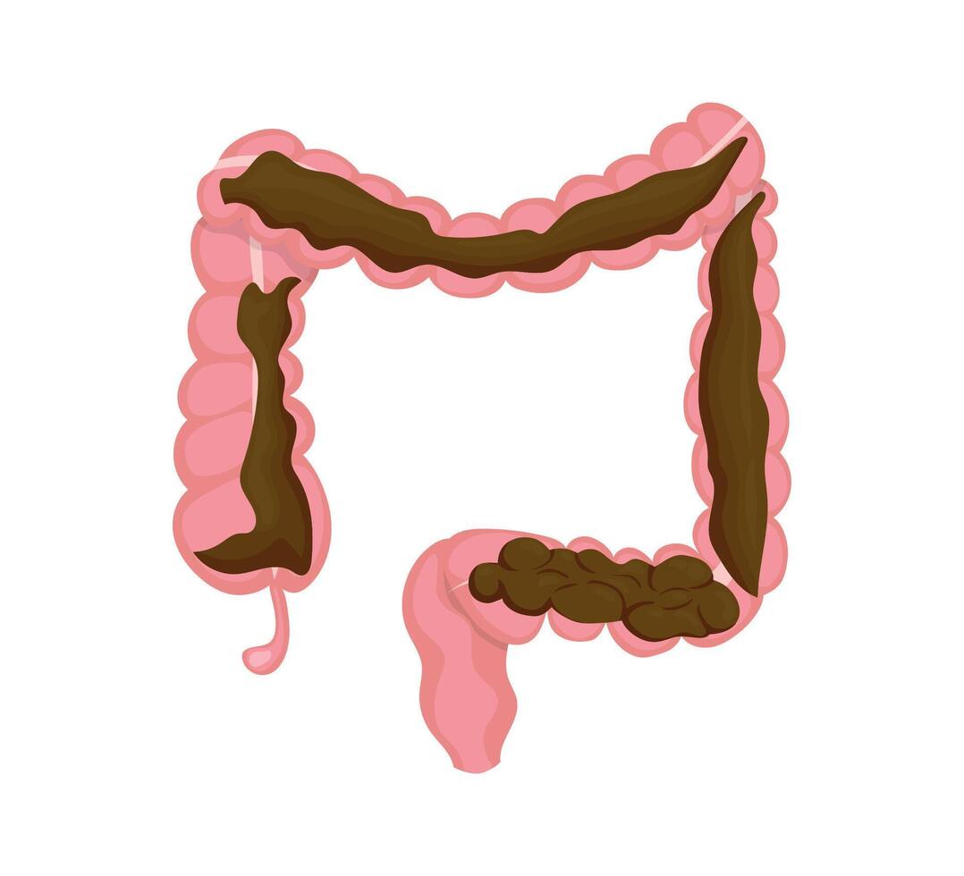 Human intestines containing feces showing normal bowel activity vector