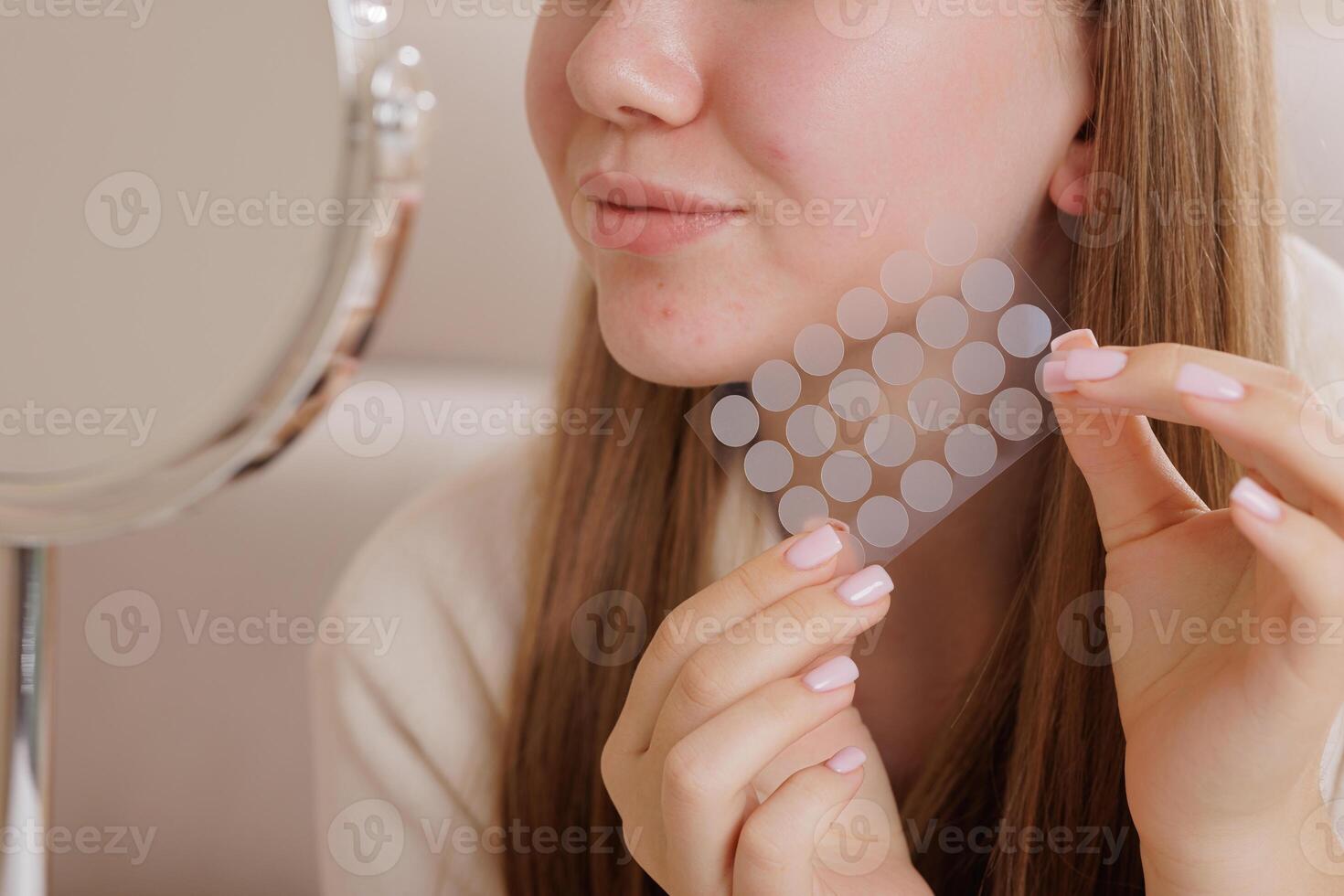 Closeup of girl applying acne patch for skincare, showing hydrocolloid spot treatment for pimples. photo