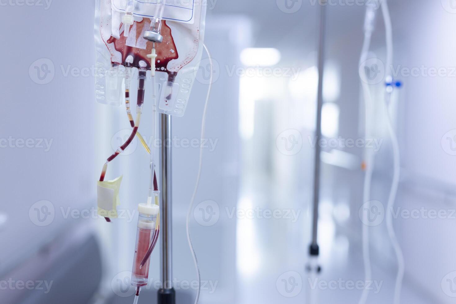 Blood transfusion bag connected to IV system in hospital hallway, sterile healthcare environment. photo