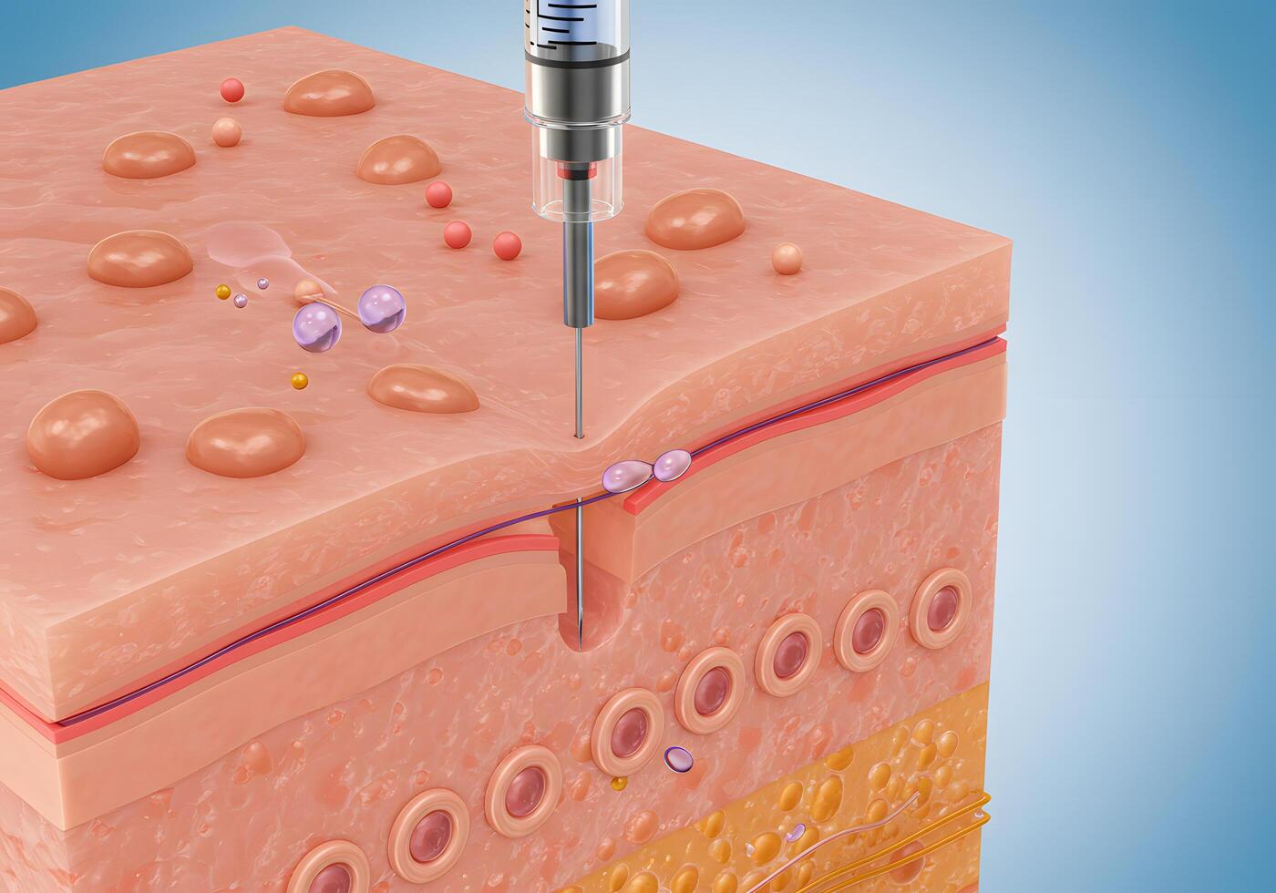 Cosmetic injection procedure illustration photo