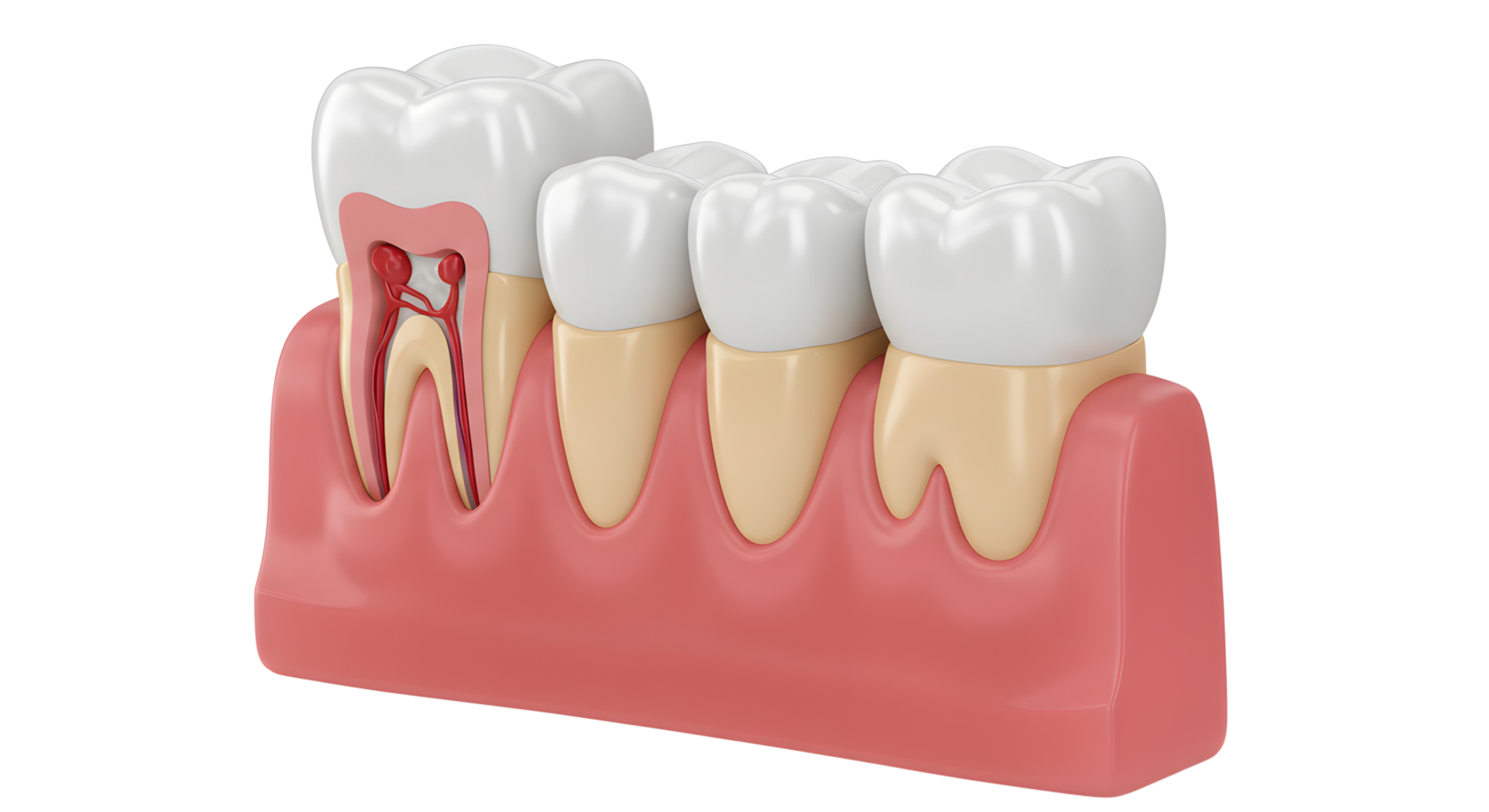 A tooth with a root canal png