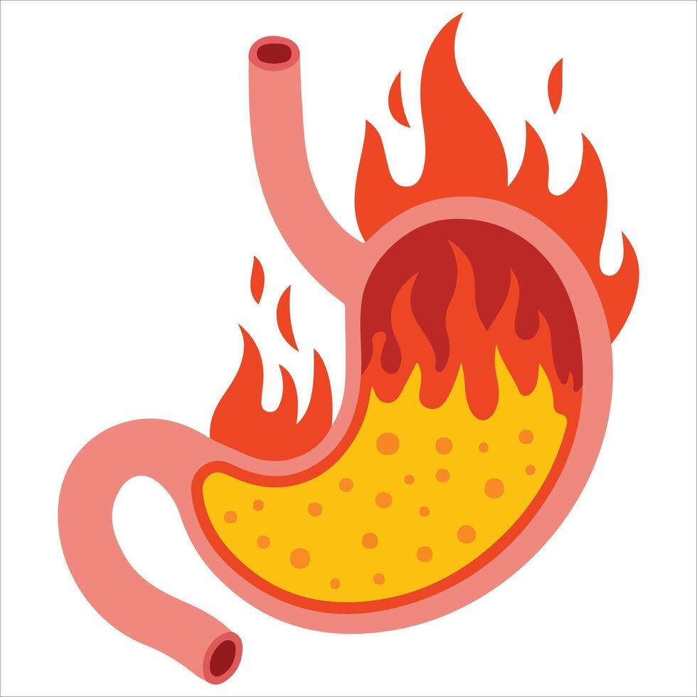 Burning stomach acid reflux isolated illustration on white background vector